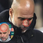 I want to hurt myself – Guardiola speaks on scratches on his nose, face